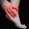 upload/articles/thumbs/120712035007achilles tendonitis edit.jpg